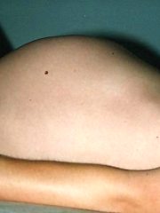 Pregnant Amateurs